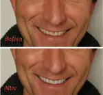 How to Quickly and Effectively Whiten Teeth in Photoshop How to Quickly and Effectively Whiten Teeth in Photoshop