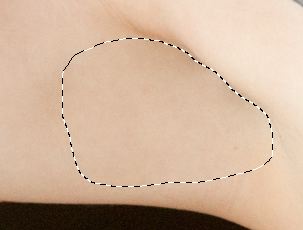 Patched Armpit